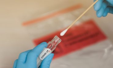 Procon fiscaliza farmácias e laboratórios sobre aumentos abusivos de preço de testes de covid