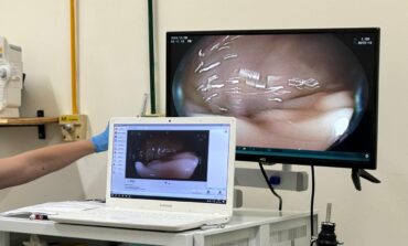 Mutirões de Endoscopia e Colonoscopia Avançam na Redução da Fila de Espera